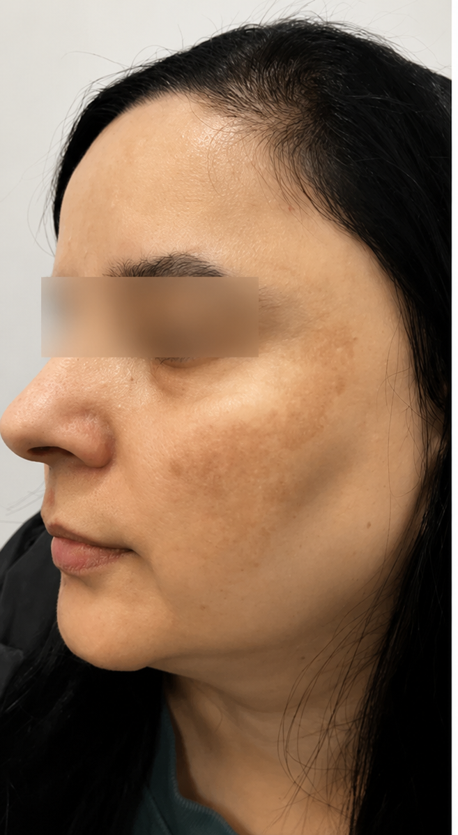 Before Image