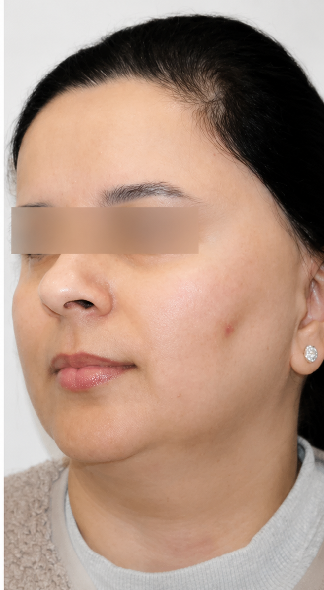 After Image